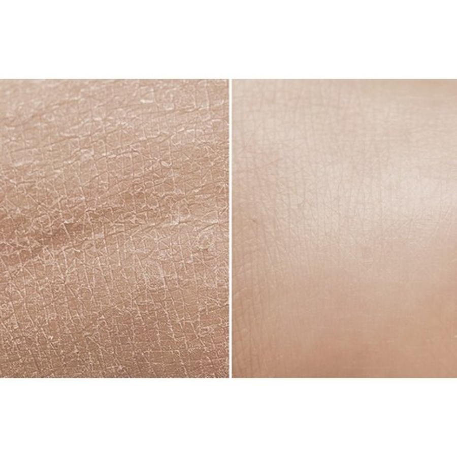Гель-пилинг Heal Seed Amazing Aqua, 150 мл