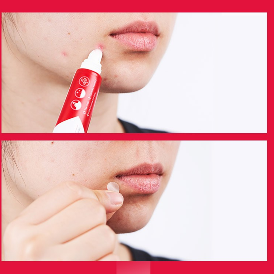 Paul Medison Deep Red Centella Spot Care Gel – гель для точечного ухода с центеллой, 25 г, 1 шт.